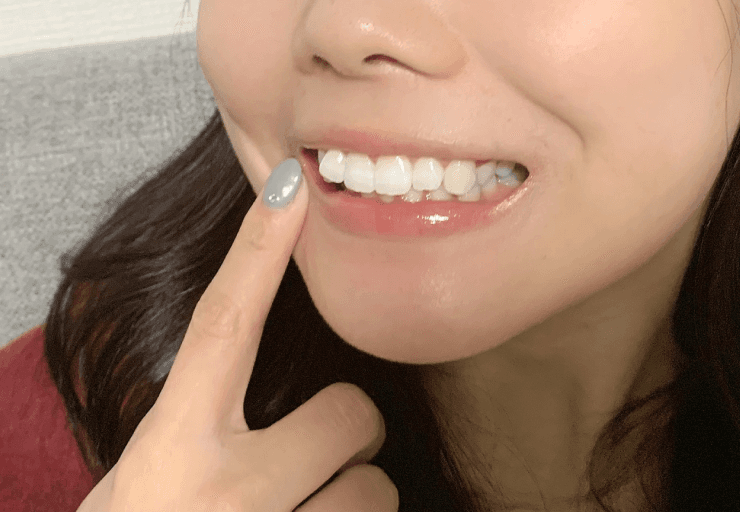 取り外しも簡単